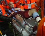 http://content1-foto.inbox.lv/albums29895657/eitmd49r/turcija-futbols/musa-buyuk-injury.jpg